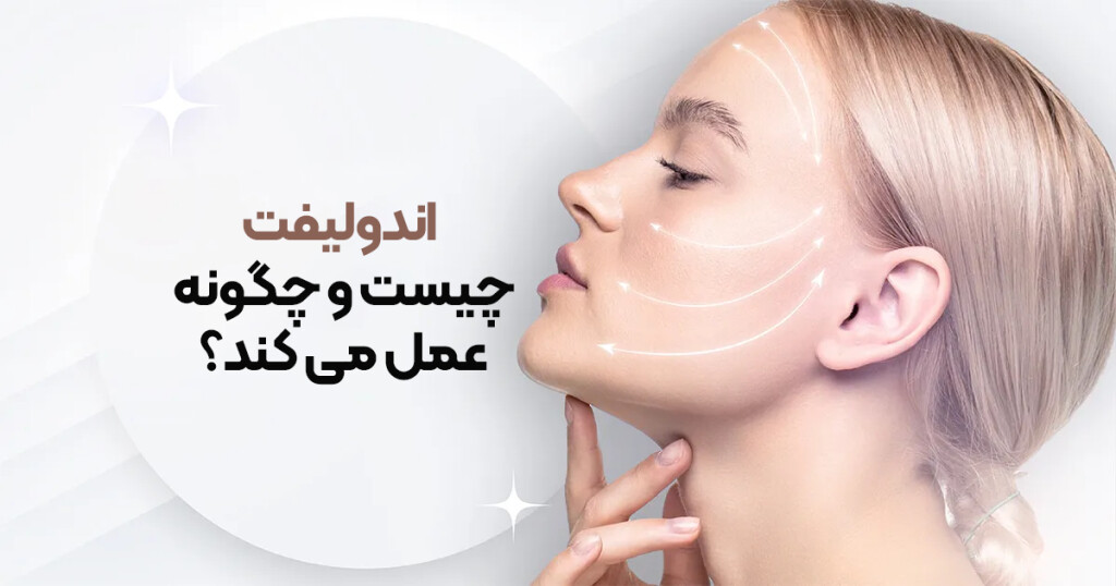 اندولیفت؛ جایگزین تکنیک‌های سخت و سنگین جوانسازی